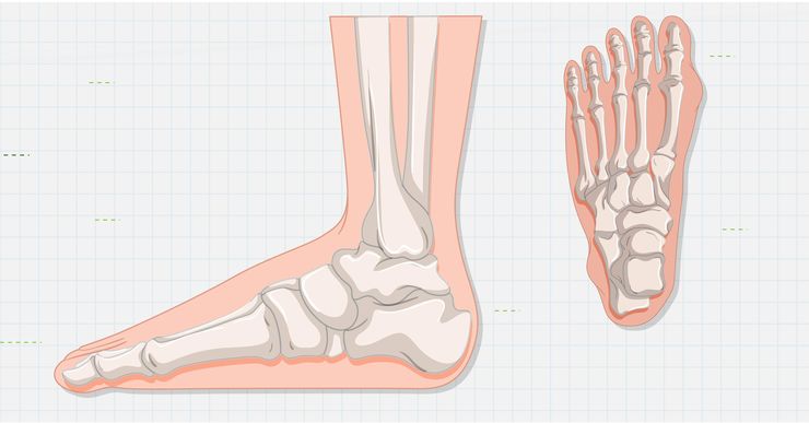 “Pie plano” es la expresión médica que se usa para describir el pie que pierde parcial o totalmente el arco longitudinal interno en el apoyo.